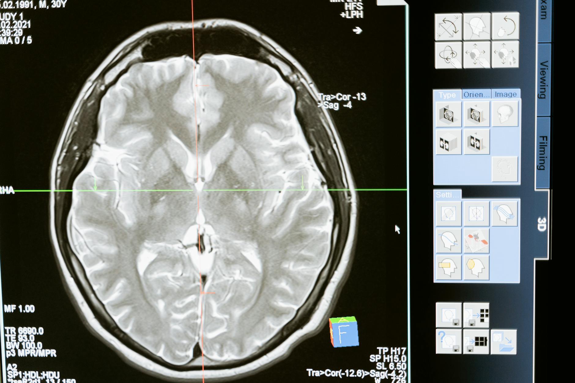 Claude Lemieux's brain donated to CTE research
