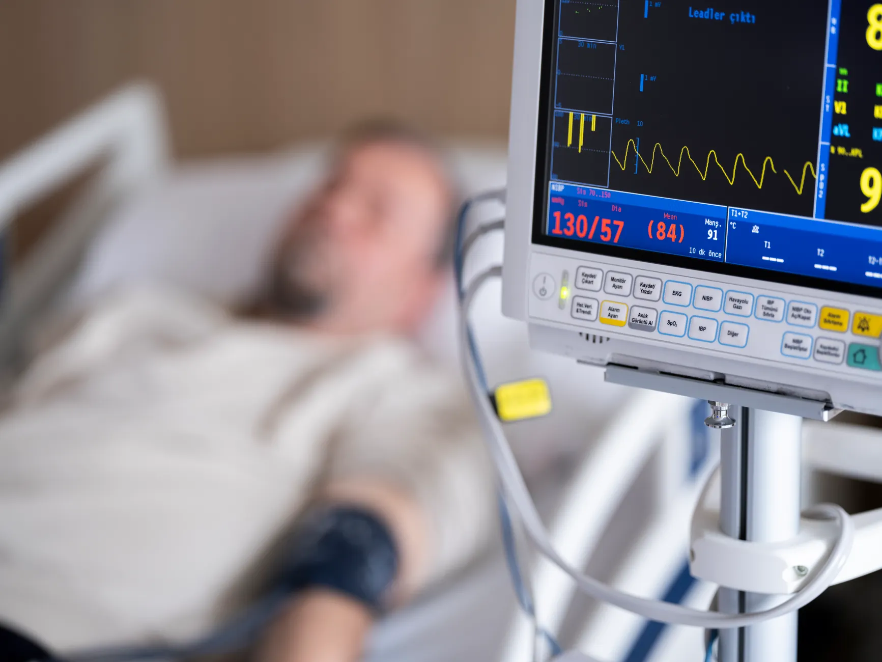 Montreal nephrologist's Guillain-Barré diagnosis offers rare view of paralysis disorder
