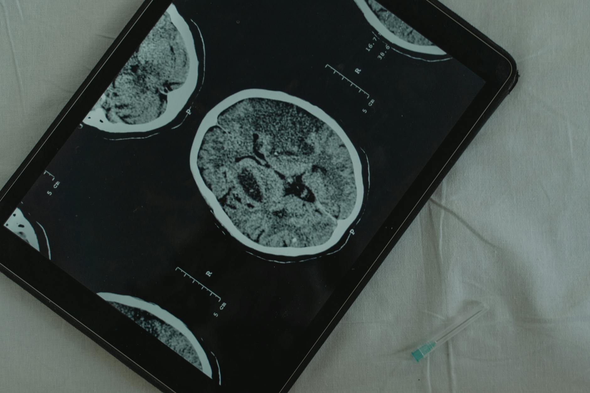Claude Lemieux's brain donated to CTE research
