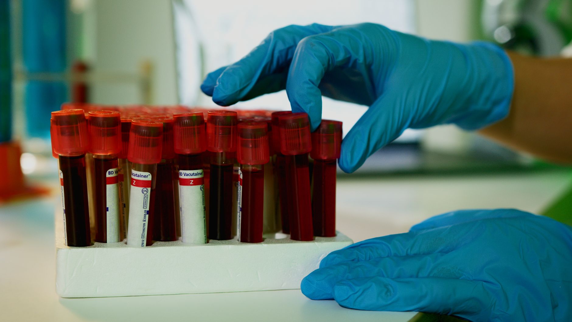 Blood test trials aim to detect cancer recurrence before CT scans can see it