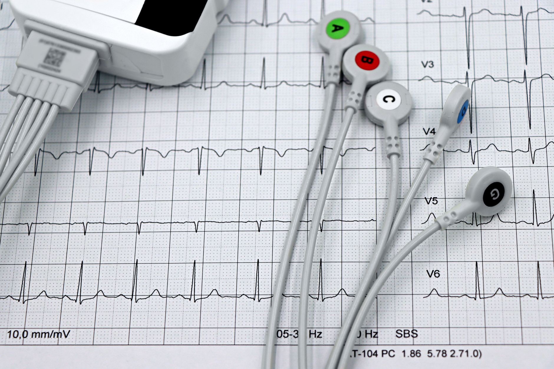 Canadian scientists racing to diagnose CTE before death